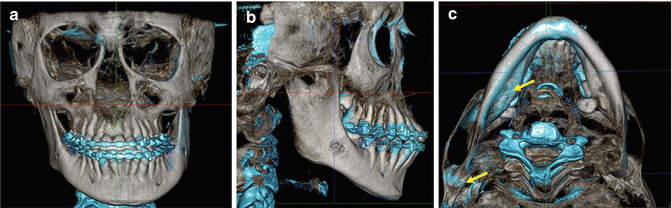 figure 71