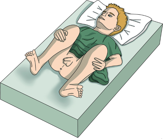 genital pediatric exam Genital Examination Techniques | SpringerLink
