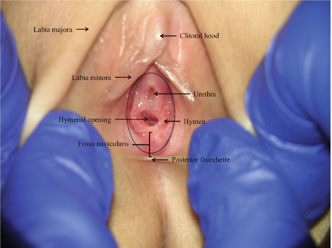 child female vaginal examination 