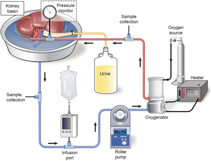Machine Perfusion of Organs