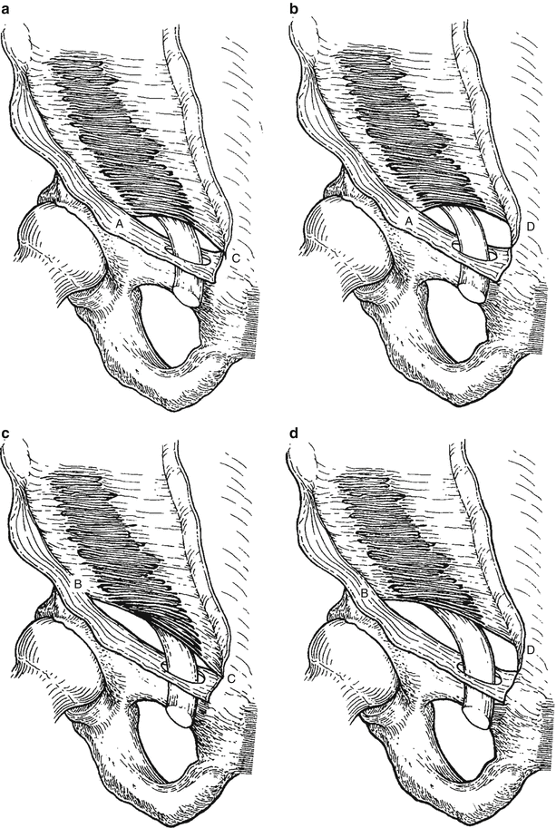 figure 21