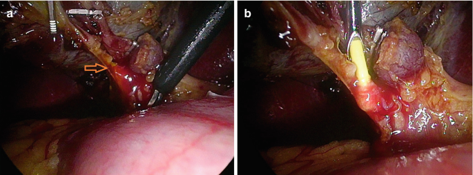 figure 32