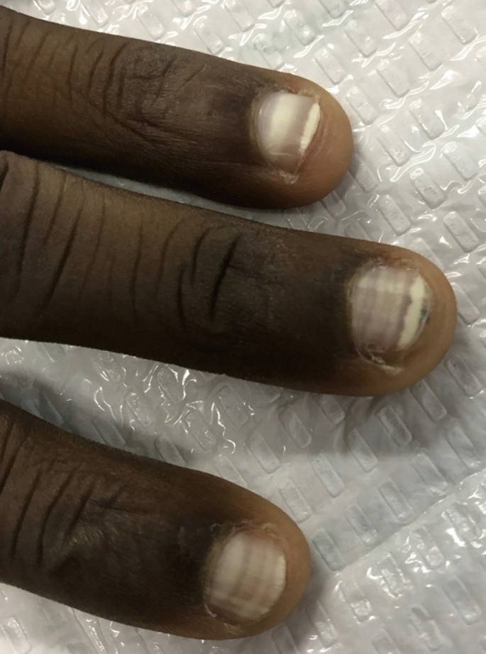 Tronetti: Healthy nails = healthy you
