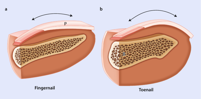 Cosmetic and functional results of a newly reconstructed thumb by combining  the phalanx of second toe and the great toenail flap transplantation |  Journal of Orthopaedic Surgery and Research | Full Text