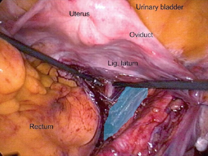 Surgical Anatomy of the Bladder | SpringerLink