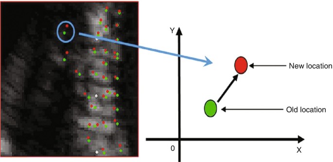 Color-coded polar diagram obtained by speckle-tracking echocardiography