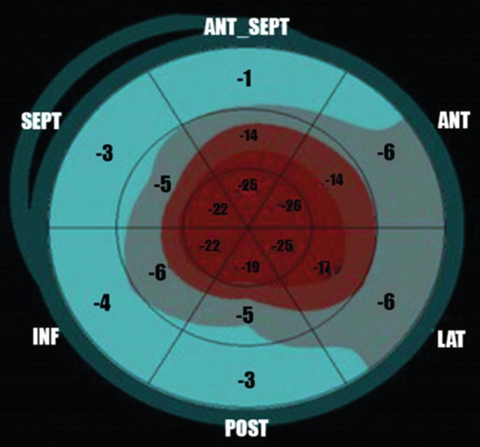 figure 21