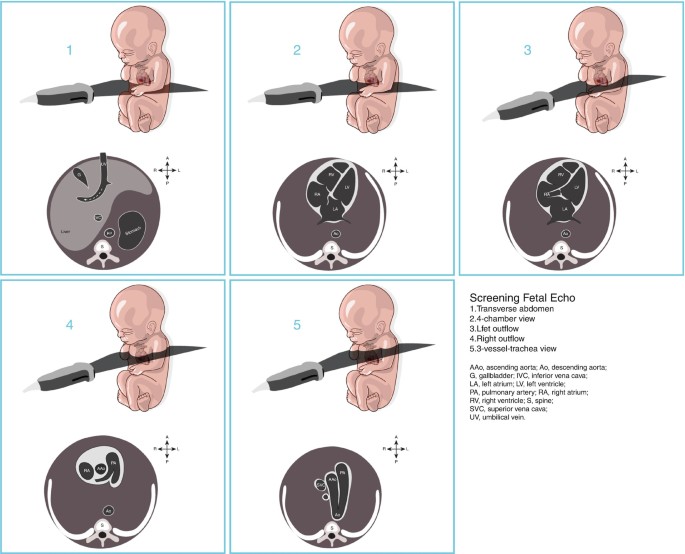 Basic Principles of Fetal Echocardiography   SpringerLink