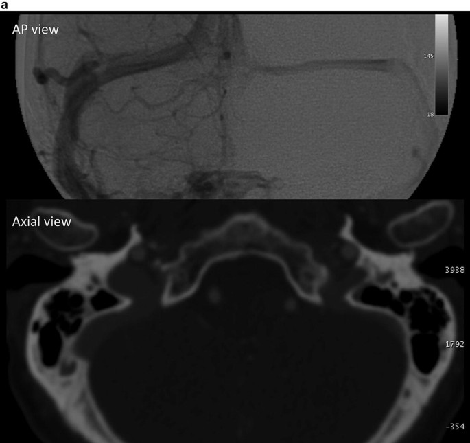 figure 15