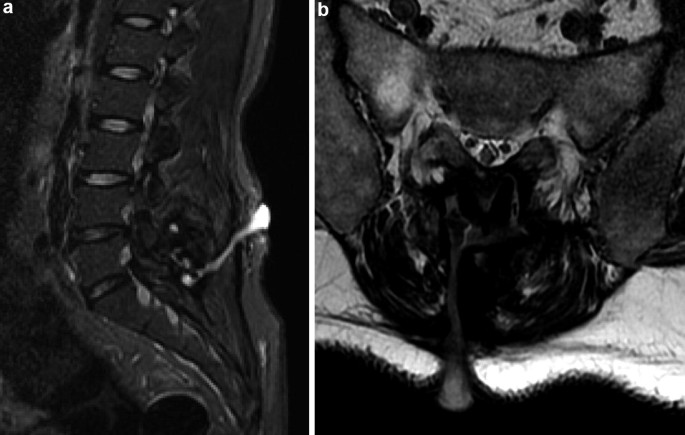 figure 38