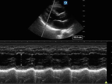 Introduction: Basic Ultrasound Principles