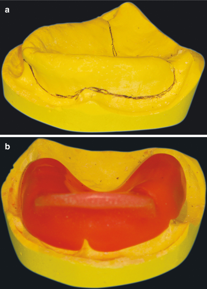 figure 55