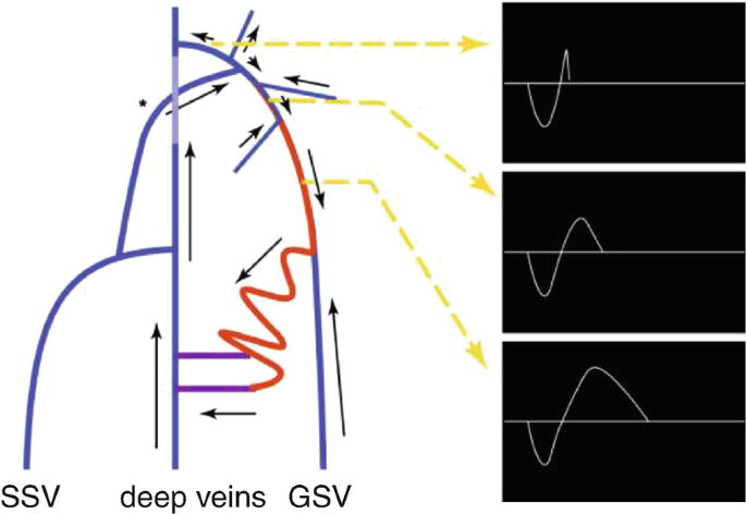 figure 22