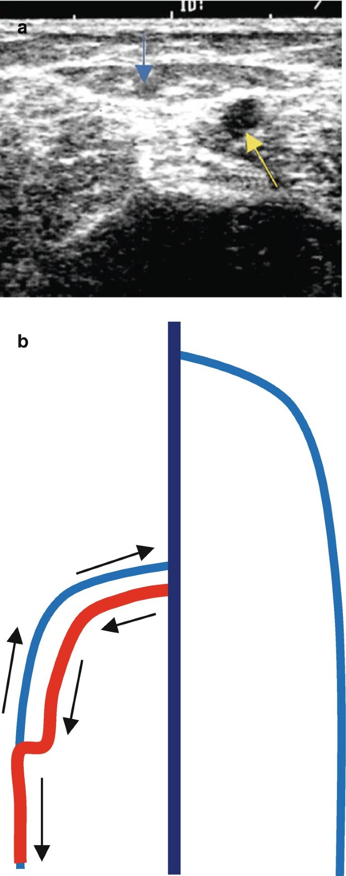 figure 31