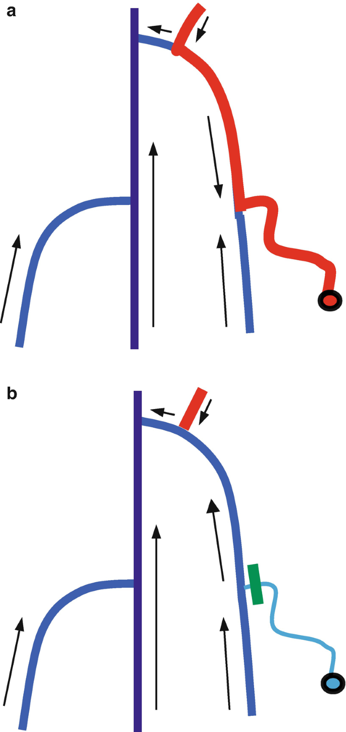 figure 18