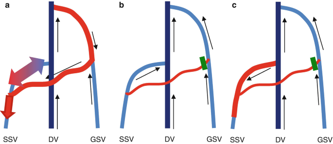 figure 46