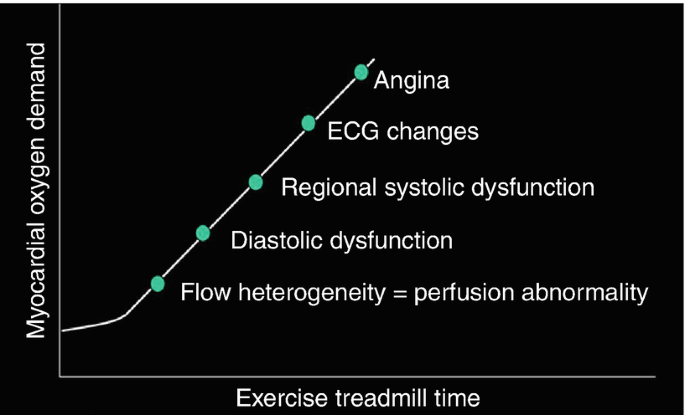 Regional wall motion abnormalities in coronary artery disease – All About  Cardiovascular System and Disorders