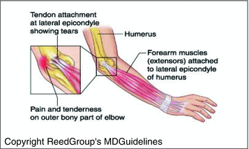 figure d