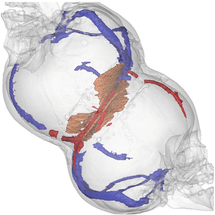 figure 17