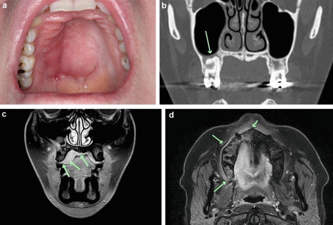 figure 37