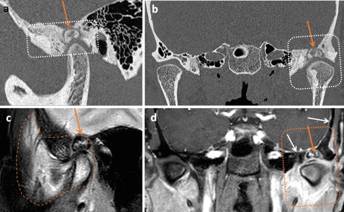 figure 116