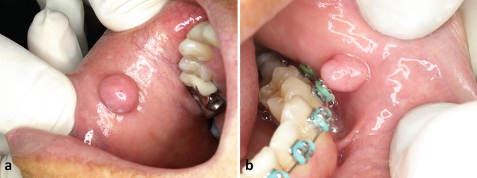 figure 17