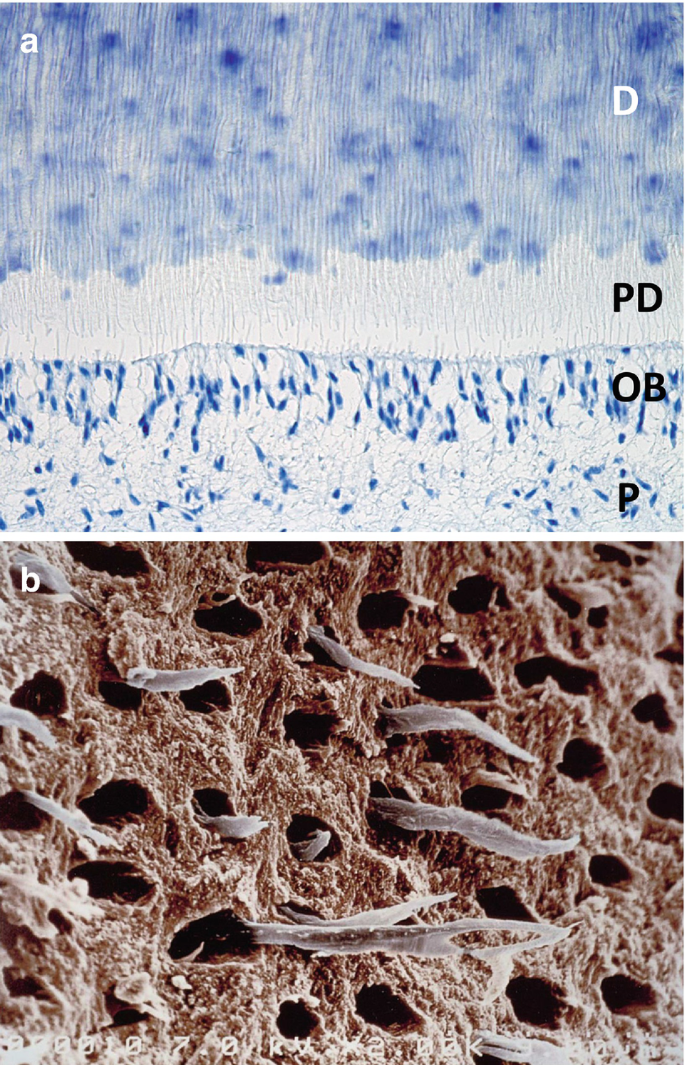 Light micrographs showing several regions of the dentin-pulp interface