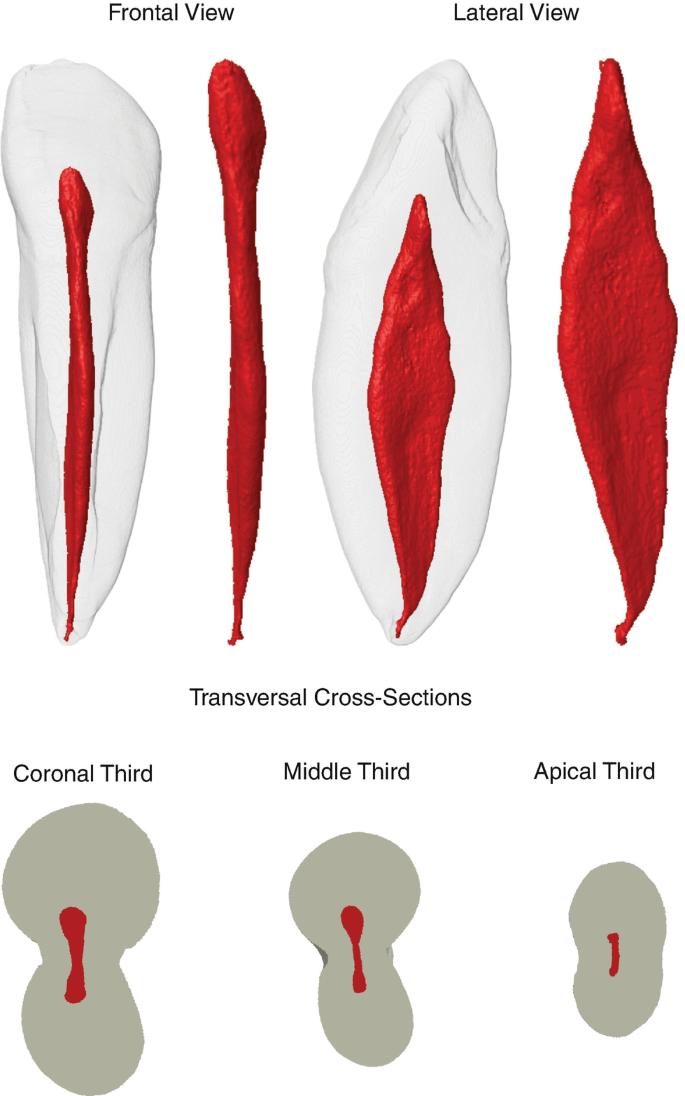 Root Canal Anatomy of Maxillary and Mandibular Teeth | SpringerLink