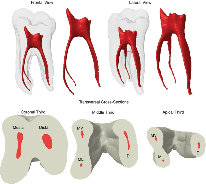 Root Canal Anatomy of Maxillary and Mandibular Teeth | SpringerLink