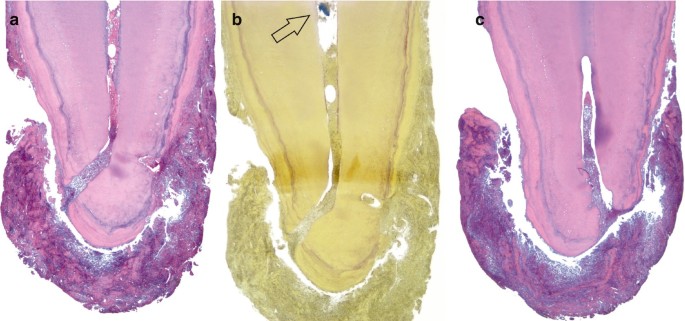 apical foramen histology