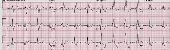 figure 38