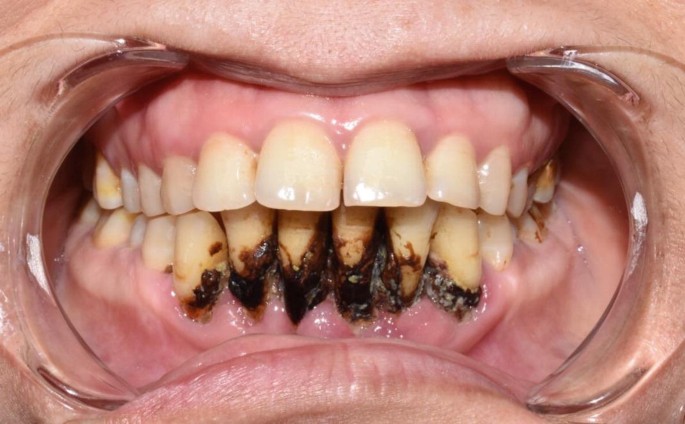 is chewing tobacco haram Tobacco Use by Arab Women