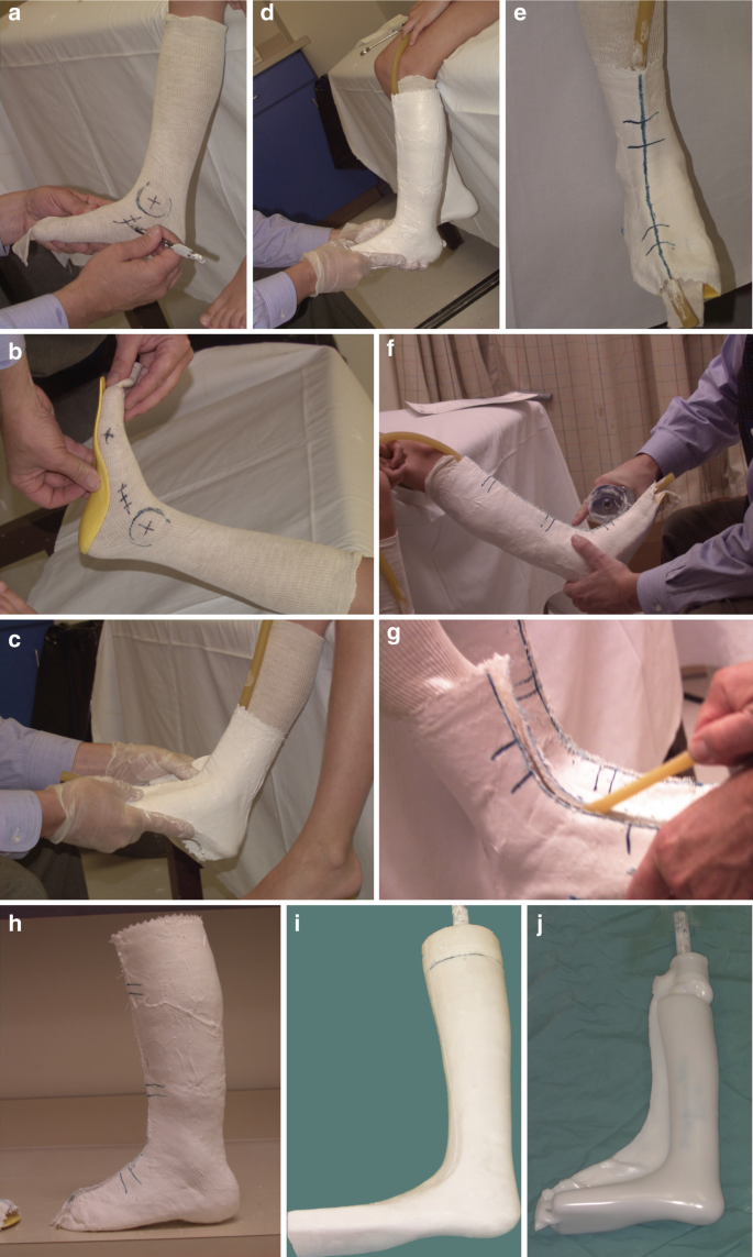 Lower Extremity Orthoses for Children and Youth with Cerebral Palsy