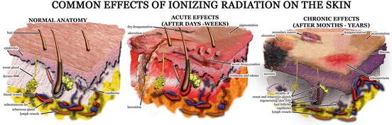 radiation poisoning effects on human