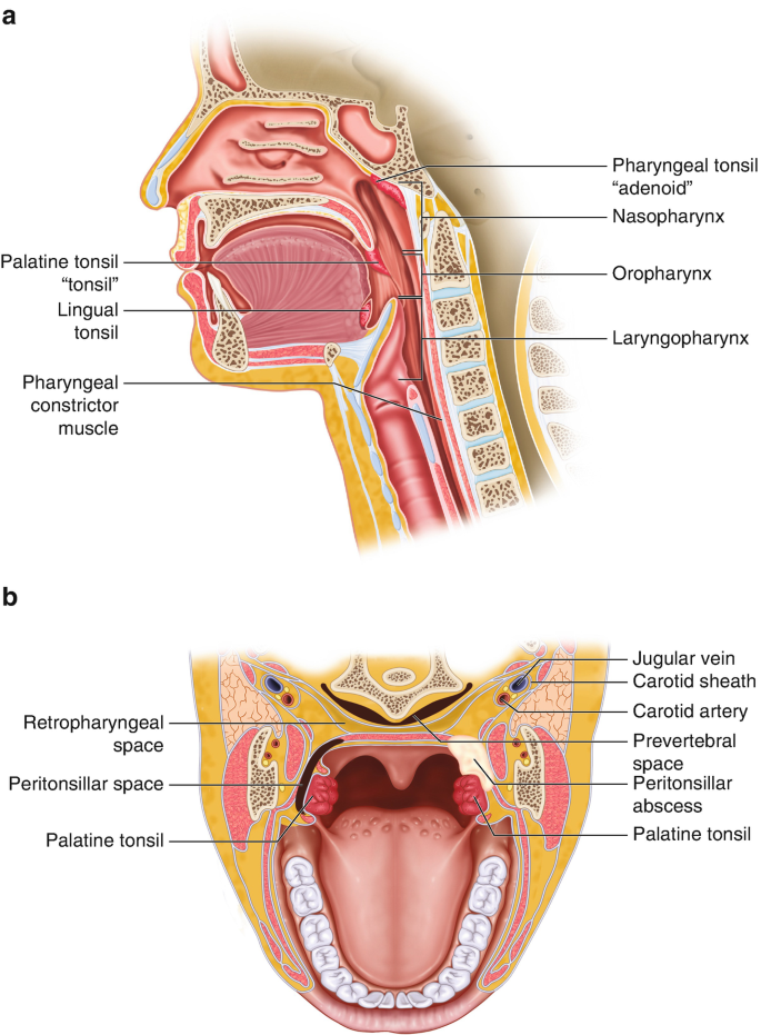 streptococcal pharyngitis diagram