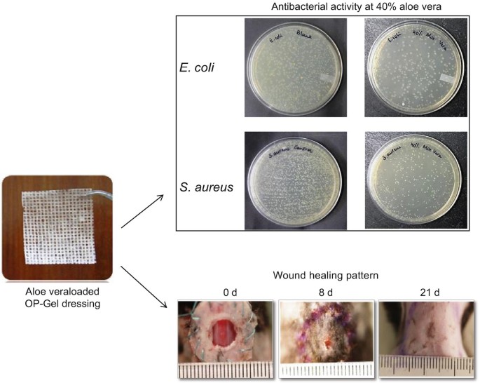 Polysaccharide–Aloe vera Bioactive Hydrogels as Wound Care System |  SpringerLink