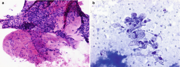 figure 16