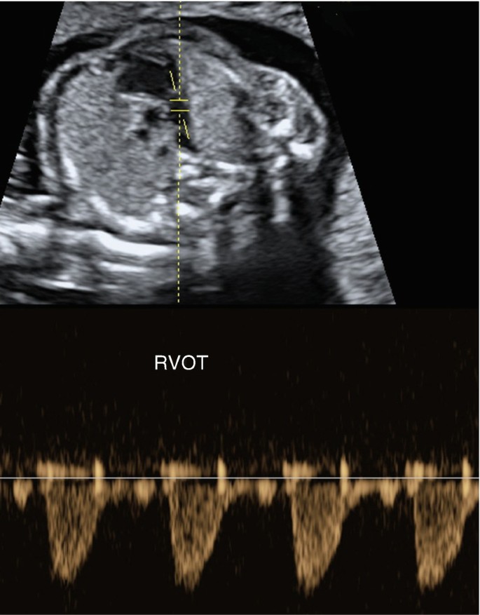 figure 16