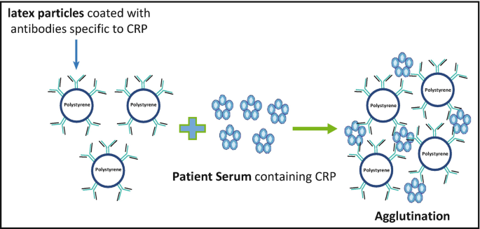 C-Reactive Protein (CRP) Latex Agglutination Test | SpringerLink