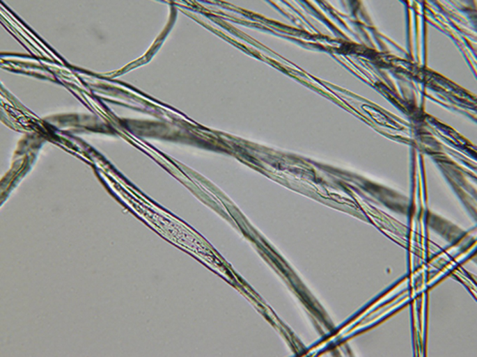 ForenScope on X: We demonstrated the performance of urine stain by  applying urine stain on light-colored underwear and developing it the day  after. The image was developed with #Forenscope Forensic Tablet; it's