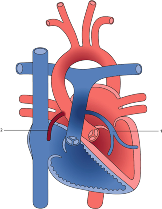 figure 29