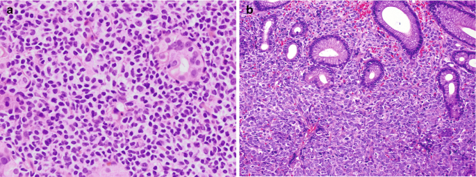 figure 23