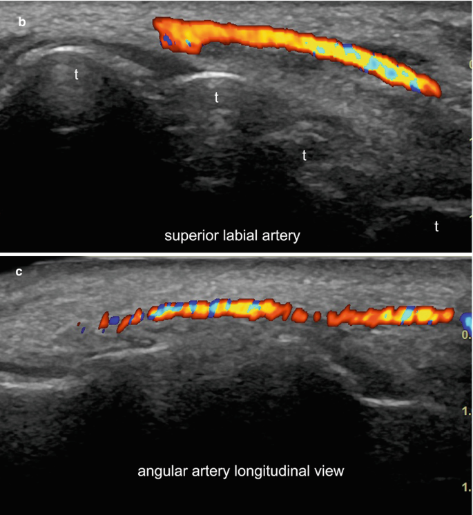 figure 29