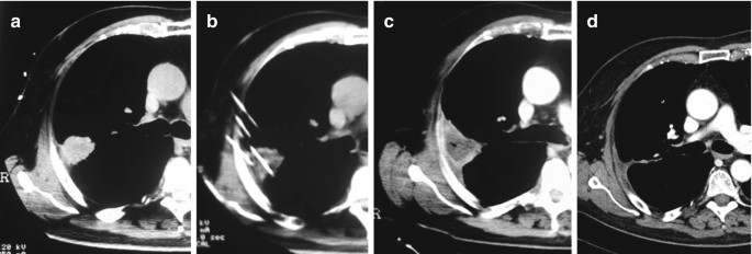 figure 22