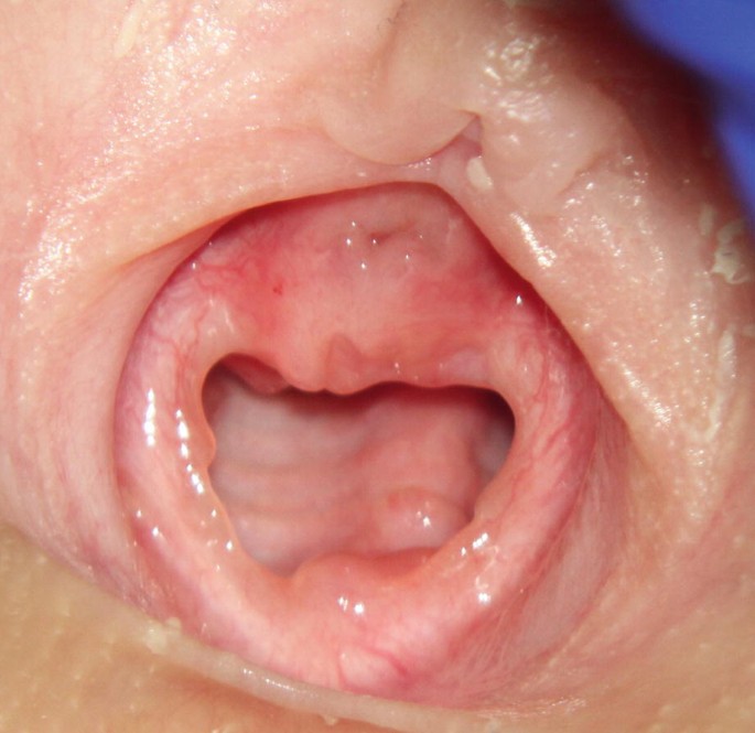 child female vaginal examination 