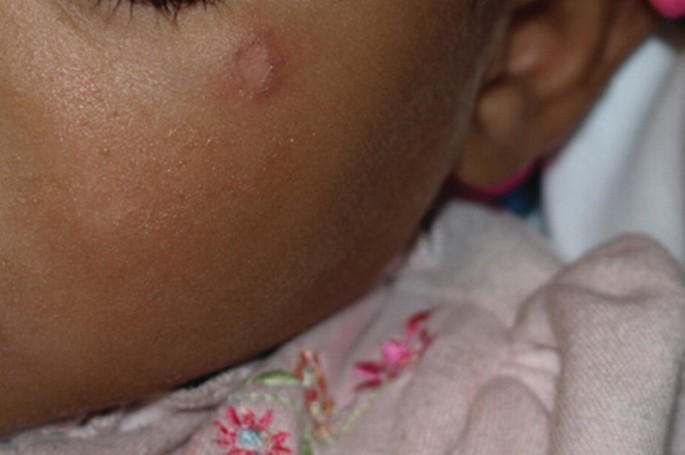 Abusive Burns