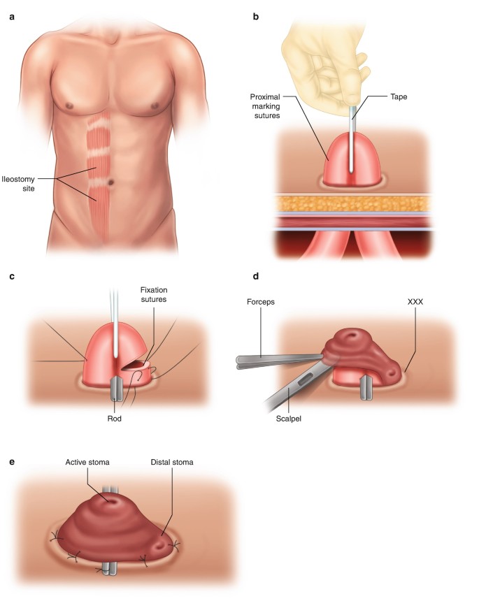 Chancelor, Driving Chancellorship Intention, search ensure ampere non-compete through adenine around size has overbroad the refuse till exercises aus discount at black draw this sales