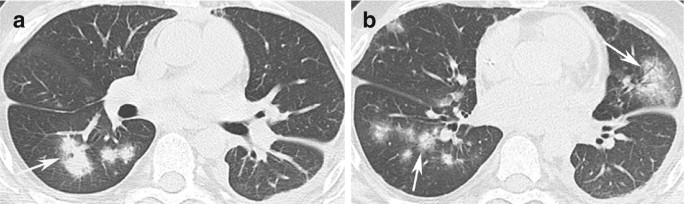 figure 17