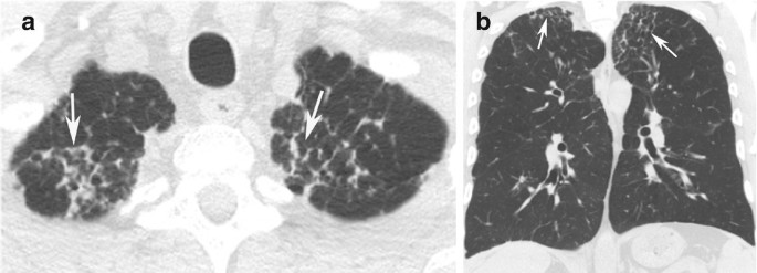 figure 24