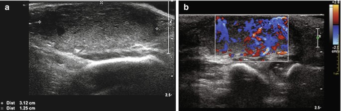 figure 16